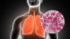 Course - Microbiology: All about Tuberculosis (TB)